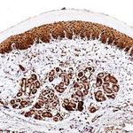 FABP5 Polyclonal Antibody