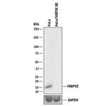 FABP5 Antibody in Western Blot (WB)