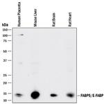 FABP5 Antibody in Western Blot (WB)