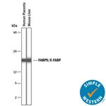 FABP5 Antibody in Western Blot (WB)