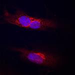 PODXL2 Polyclonal Antibody