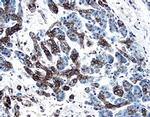 PDGF-C Polyclonal Antibody