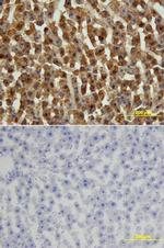 FABP1 Polyclonal Antibody
