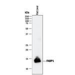 FABP1 Antibody in Western Blot (WB)