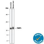 FABP1 Antibody in Western Blot (WB)