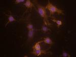 CLEC5A Polyclonal Antibody