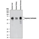 SERPINA4 Polyclonal Antibody
