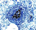WISP1 Polyclonal Antibody