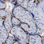 LOX-1 Polyclonal Antibody