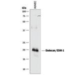 Endocan Polyclonal Antibody