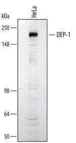 CD148 Polyclonal Antibody