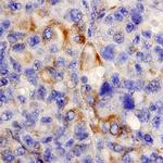 MIA Polyclonal Antibody