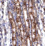 VLDLR Polyclonal Antibody