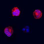 FAS Antibody in Immunocytochemistry (ICC/IF)