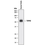 TSP50 Polyclonal Antibody