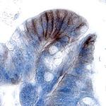 CDCP1 Polyclonal Antibody