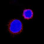 IL31RA Polyclonal Antibody