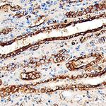 LUM Polyclonal Antibody