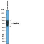 LUM Antibody in Western Blot (WB)