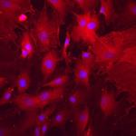 ALPL Polyclonal Antibody