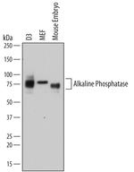 ALPL Antibody in Western Blot (WB)