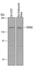 TRHDE Antibody in Western Blot (WB)