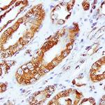 Nectin 3 Antibody in Immunohistochemistry (Paraffin) (IHC (P))
