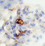 PODN Polyclonal Antibody