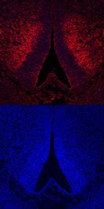 ROBO3 Polyclonal Antibody