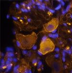 Neurofascin Polyclonal Antibody