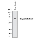 Factor VII Polyclonal Antibody