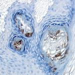 GLI1 Polyclonal Antibody