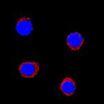 IL-1 beta Polyclonal Antibody