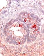 ACVR2A Polyclonal Antibody