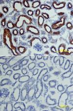 ACE2 Polyclonal Antibody