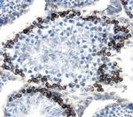 PODXL2 Polyclonal Antibody