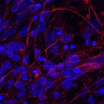 CADM3 Polyclonal Antibody