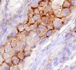 CDHR5 Polyclonal Antibody