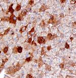 SAA4 Polyclonal Antibody