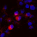 Brevican Polyclonal Antibody