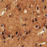 Brevican Antibody in Immunohistochemistry (Paraffin) (IHC (P))