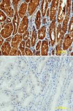 Renin Polyclonal Antibody