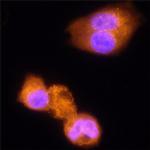 IDUA Antibody in Immunocytochemistry (ICC/IF)