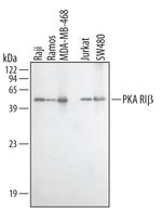 PRKAR1B Antibody in Western Blot (WB)