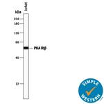 PRKAR1B Antibody in Western Blot (WB)