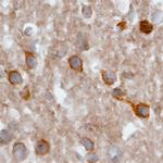 SorCS2 Polyclonal Antibody