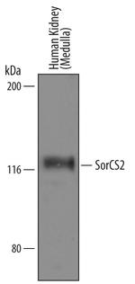 SorCS2 Antibody in Western Blot (WB)