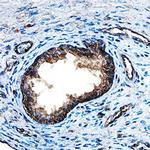 FGF8 Polyclonal Antibody