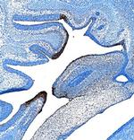 PLUNC Polyclonal Antibody