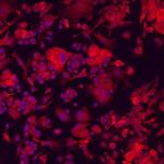 Plexin-A1 Polyclonal Antibody